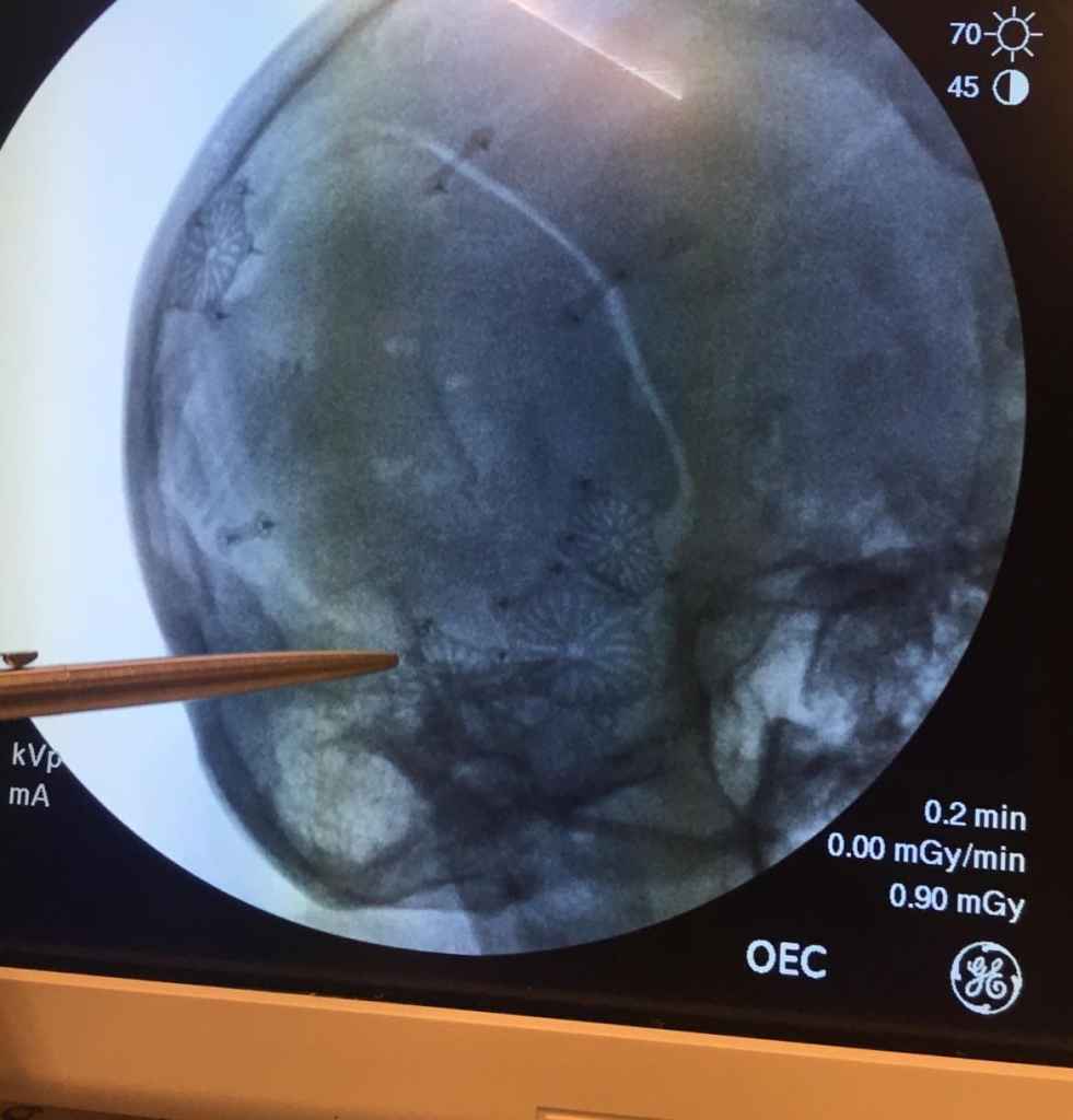 brain scan image