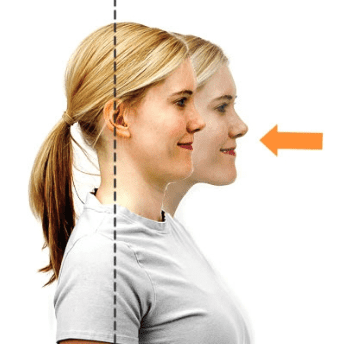 chin tuck exercise Carpal Tunnel Syndrome When Cycling