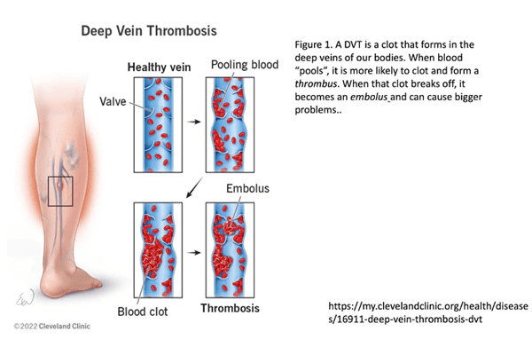 Deep Vein Thrombosis and Cycling informational diagram