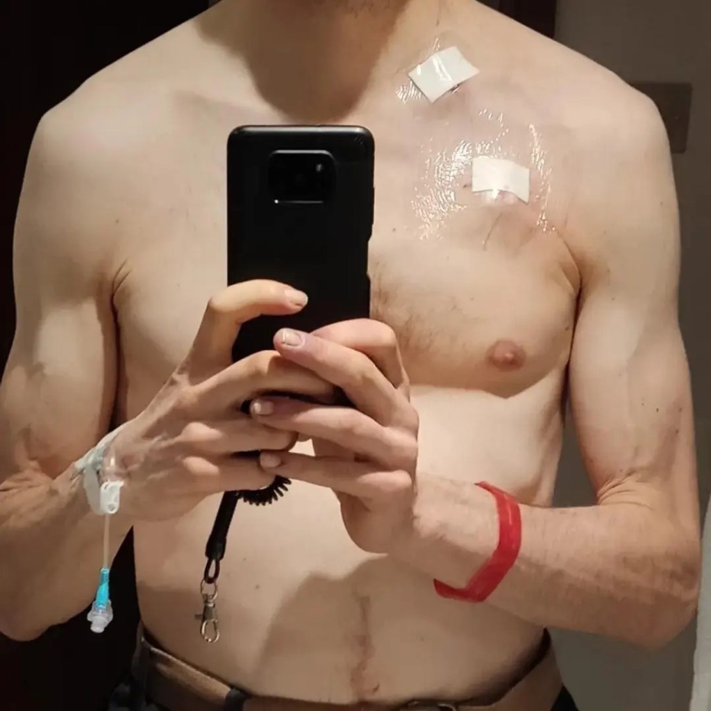 Glenn Utteridge Cancer Treatment Zwift
