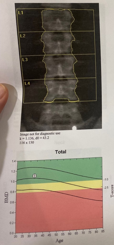 USA Cycling Esports National Champion Jacquie Godbe’s 2024 New Year’s Cycling Resolutions spine dexa scan